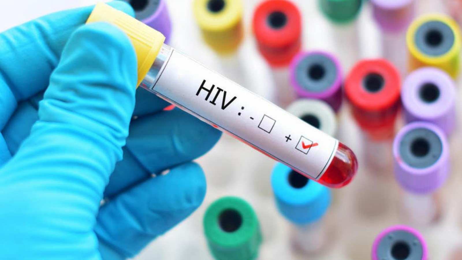 cure_for_hiv_successful_on_a_second_patient